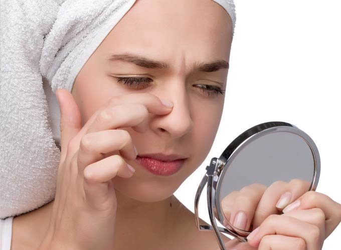 Easy & Best Homemade Remedies to Remove Blackheads Quickly